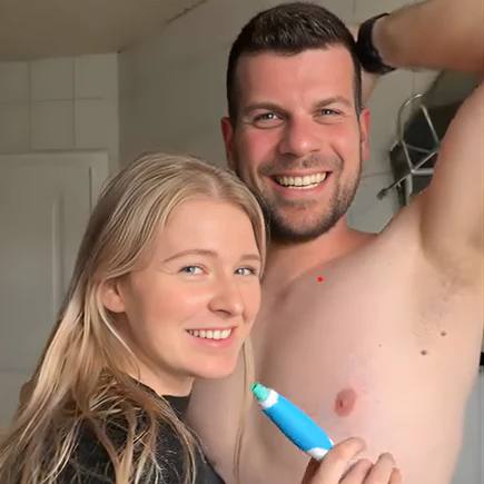 UniTag™ - Kit Professionale Rimozione Fibromi